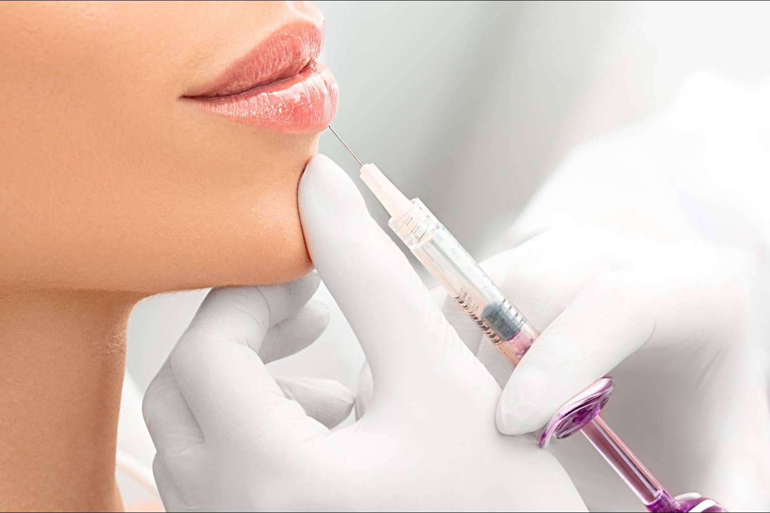 En Barcelona, el Dr. Carlos Zito realiza el aumento de labios