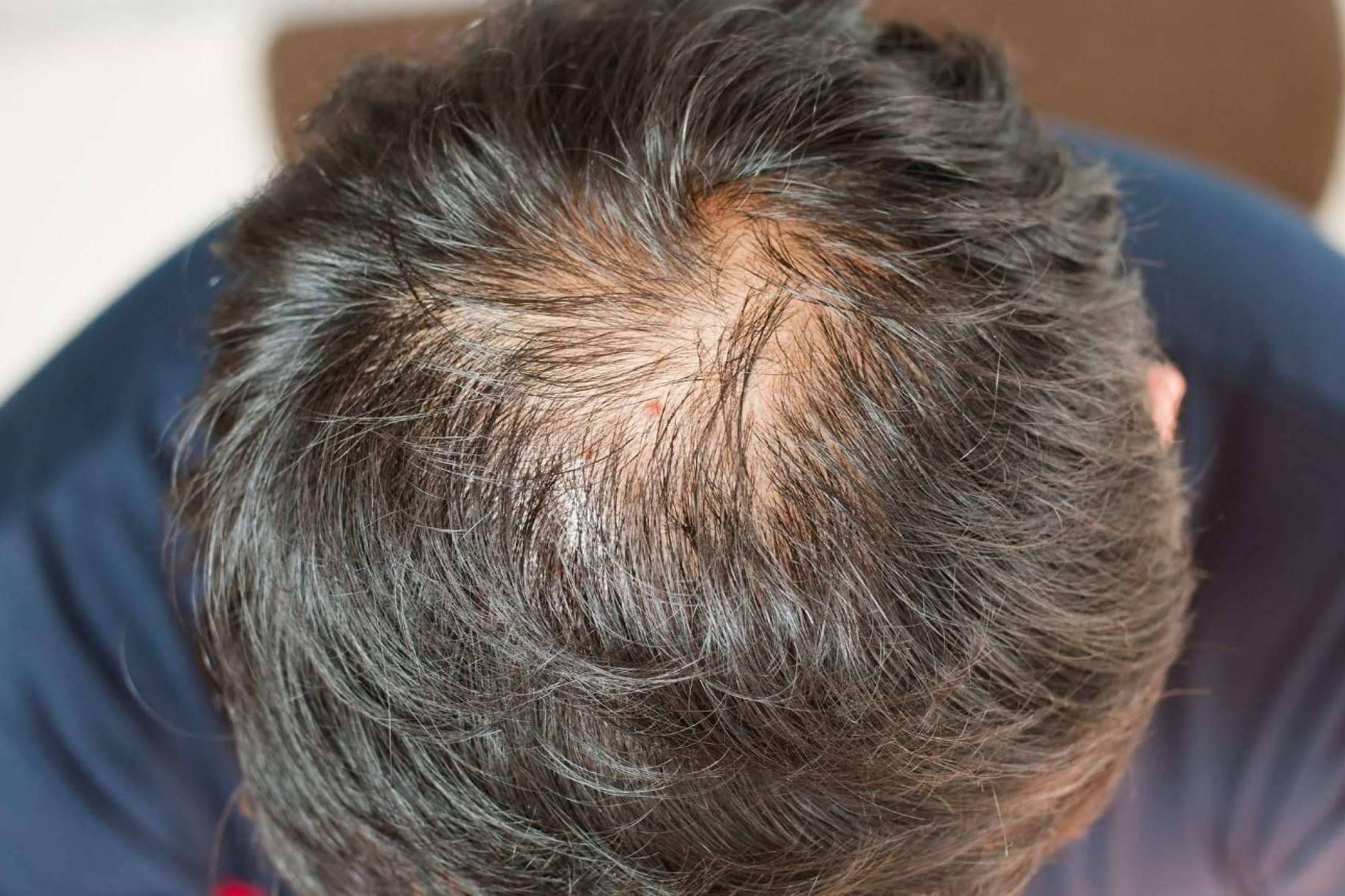 Kmax consigue combatir la caída del cabello a través de péptidos de cobre
