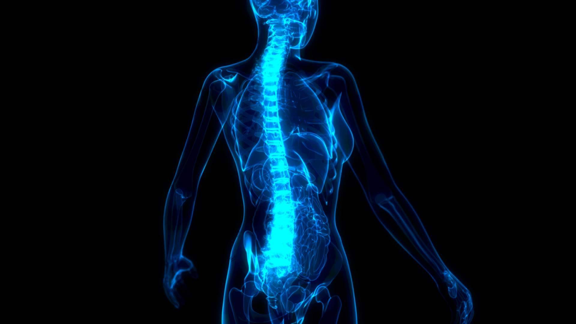 Tratar el dolor lumbar y cervical a través de la rizólisis por radiofrecuencia