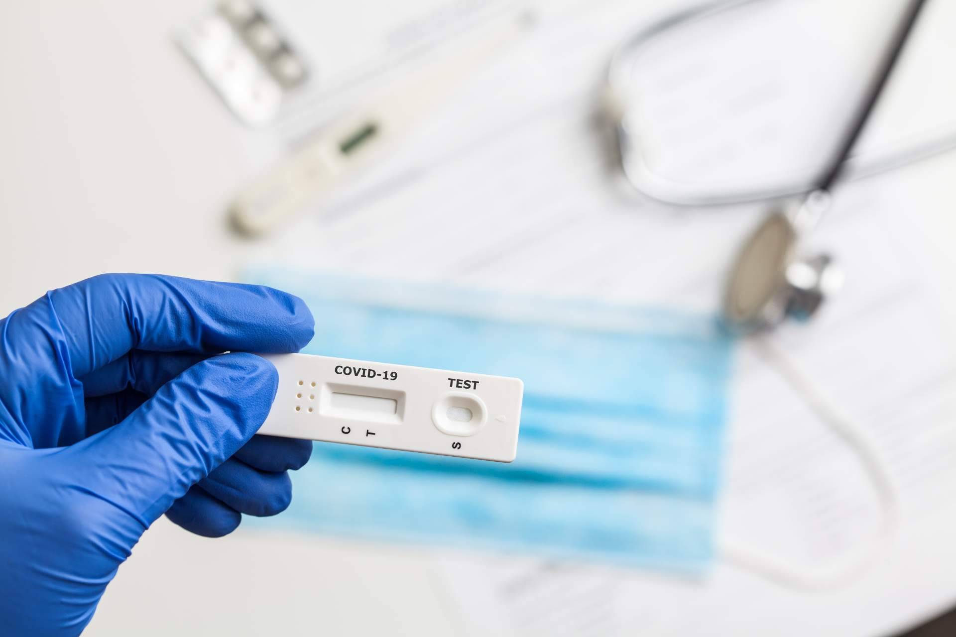Diferentes test de covid que se pueden realizar, con Centro Médico Bravo