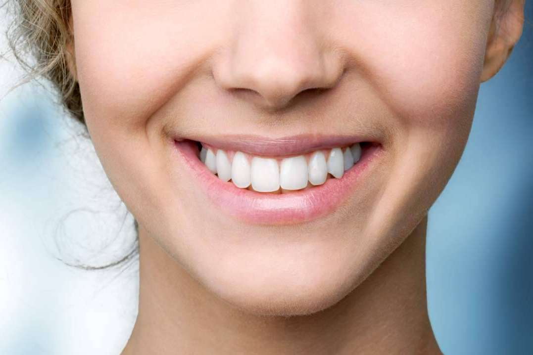 Cuidado de los dientes después de un blanqueamiento dental