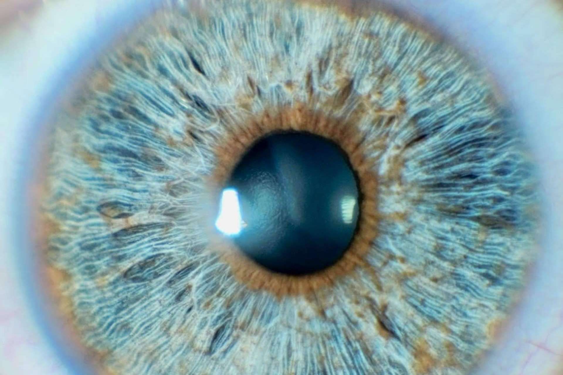 Los avances en las operaciones de cambio de color de ojos con láser, con Clínica Eyecos