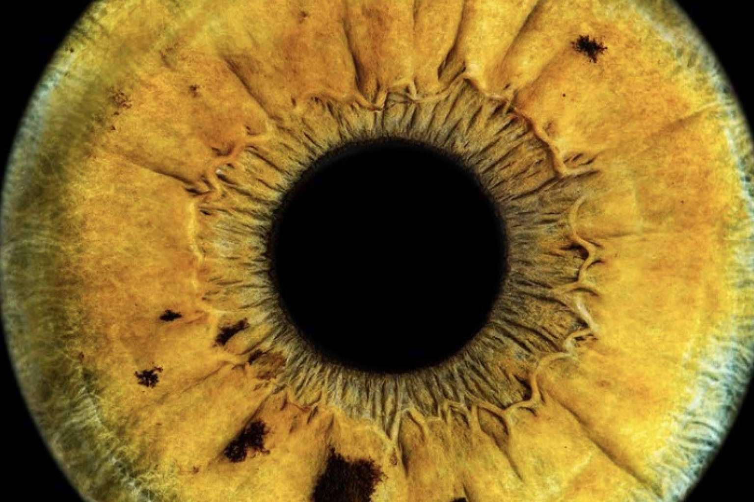 Nueva técnica fotográfica de alta definición del iris, de la mano de Eyecos