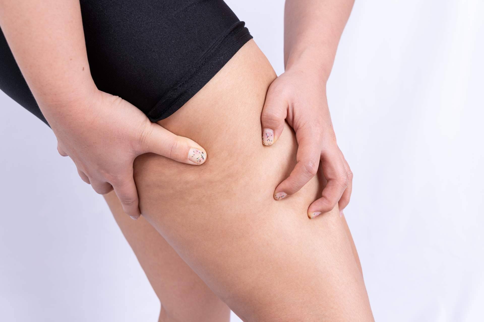 ¿Realmente funciona? Vacuslim 48, tratamiento corporal para tratar y reducir la celulitis