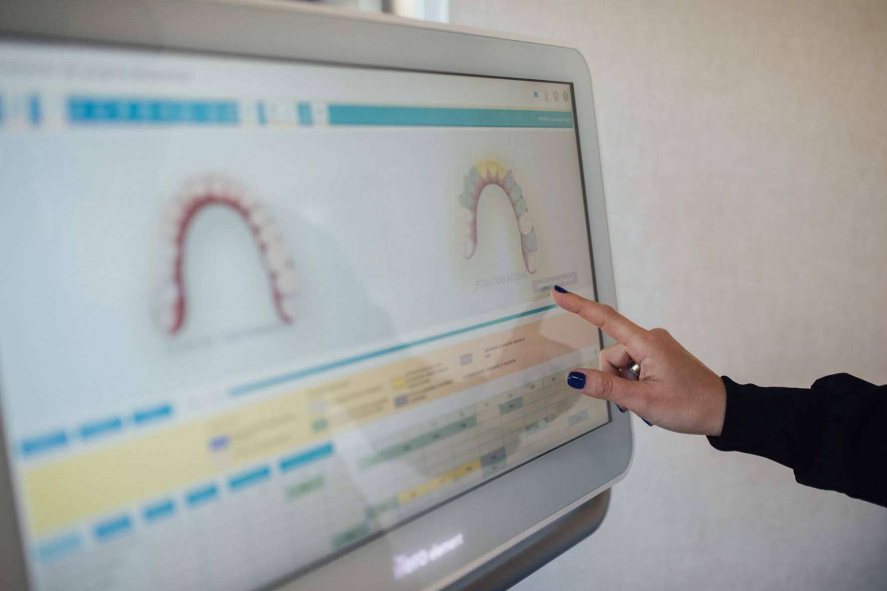 Tratamiento especializado de patologías dentales crónicas en Clínica Dental Claris