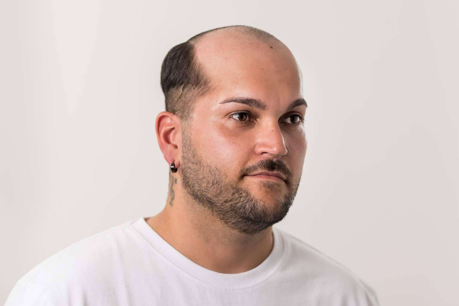 Las prótesis capilares para hombre, un mercado en auge, con Hair Inspira