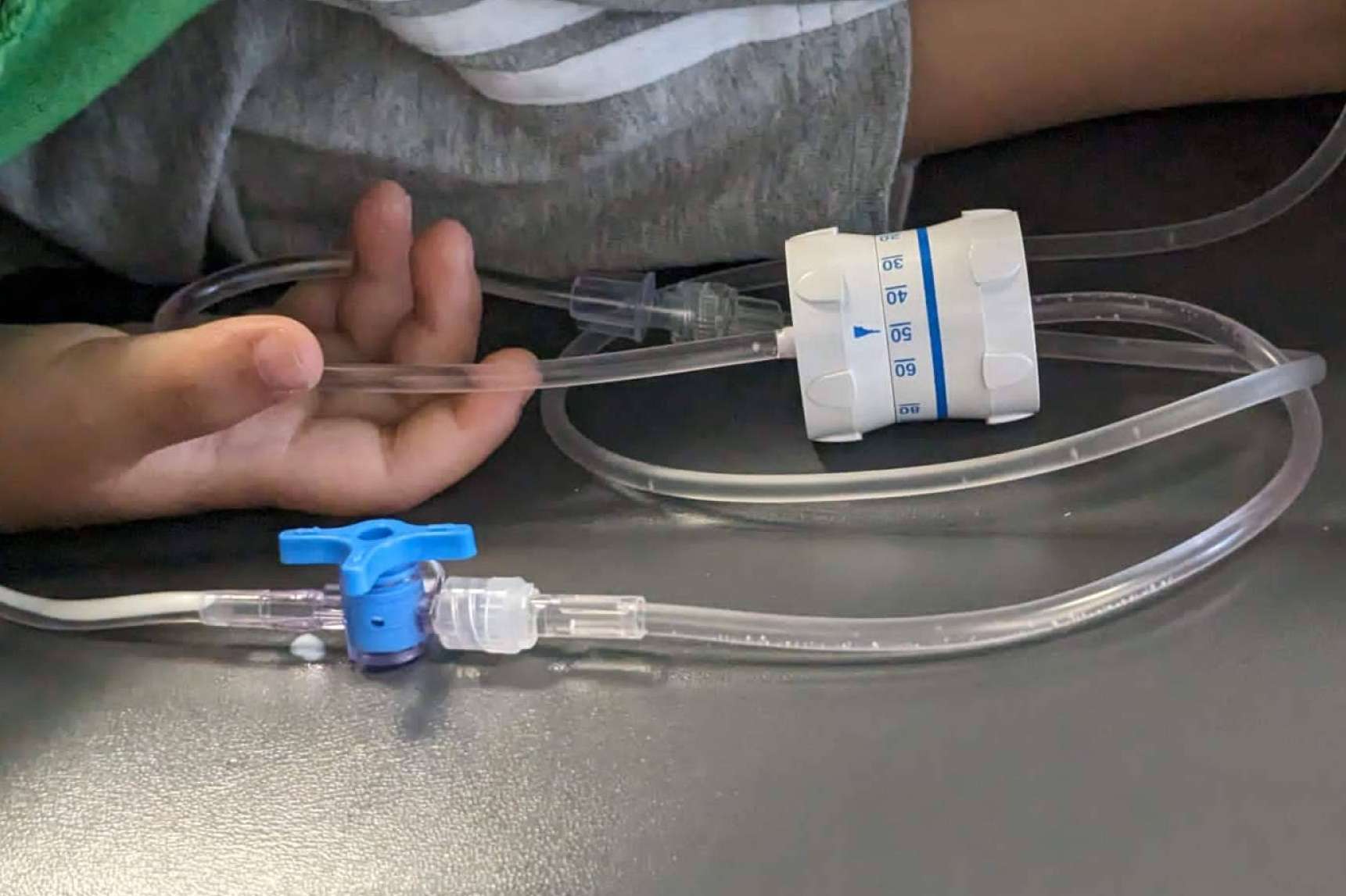 La sedación consciente para una experiencia sin miedo al dentista, Clínica Dental Ulman