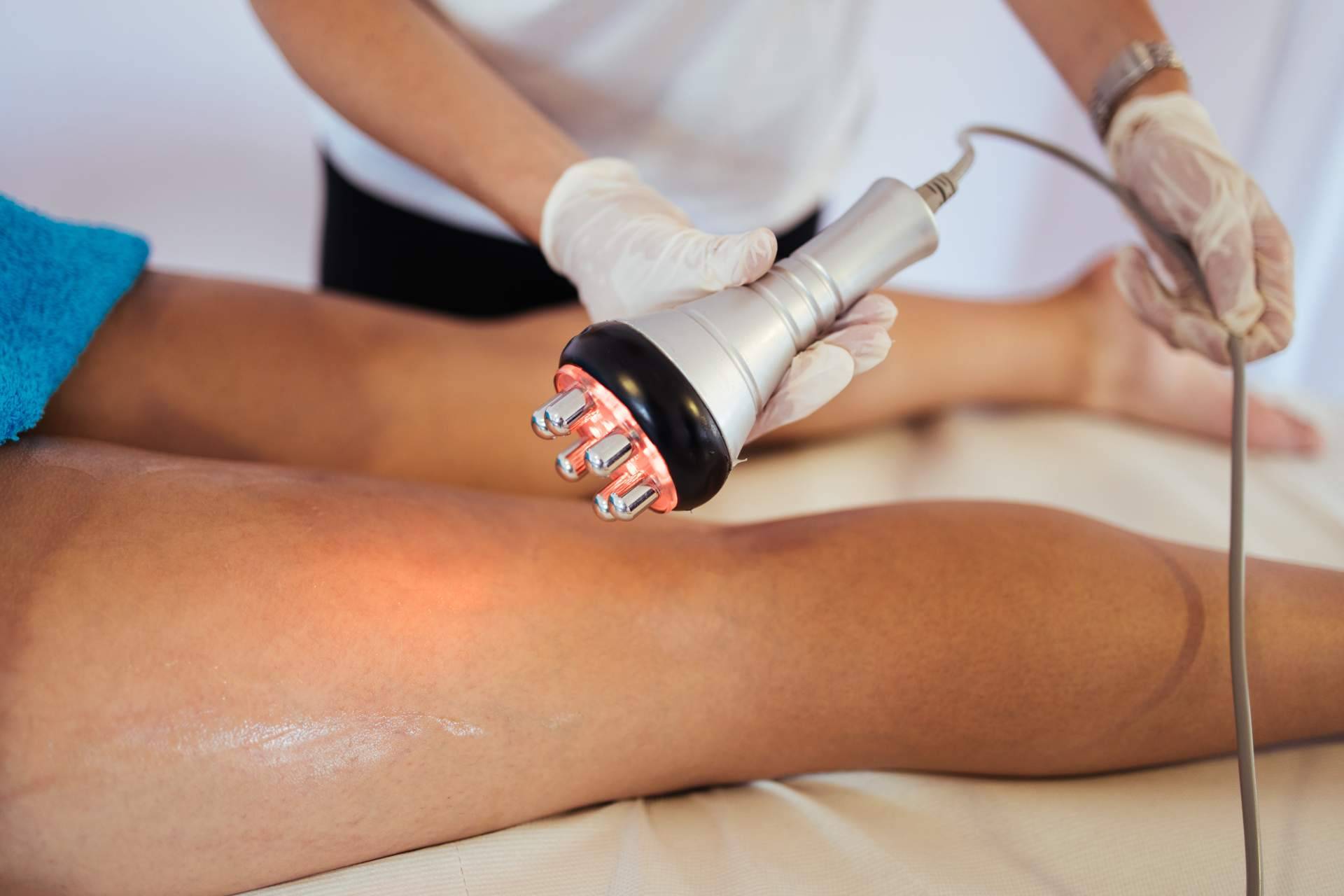 ¿En qué consiste el tratamiento de radiofrecuencia corporal?, por Centro Médico El Pilar