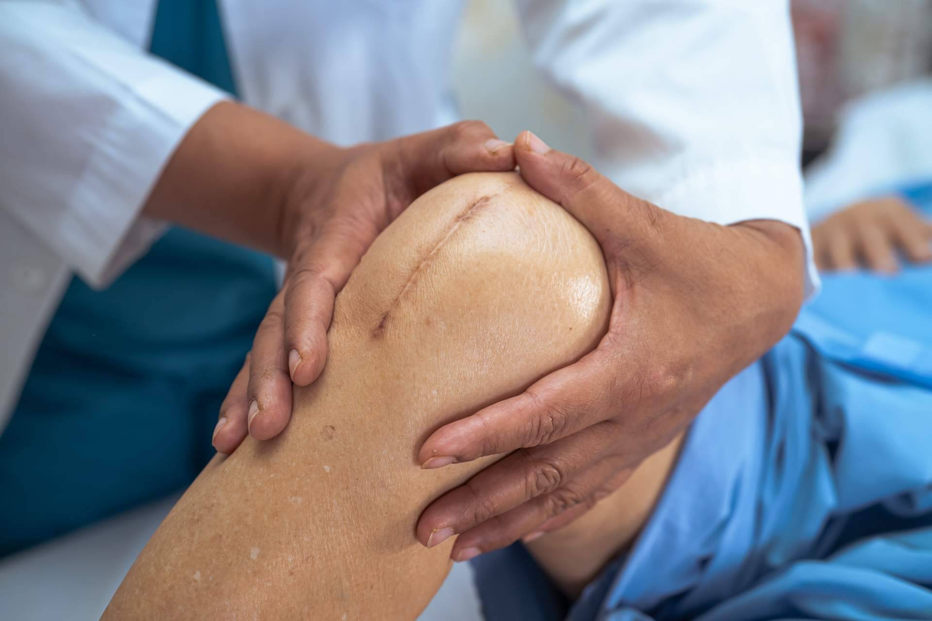 Descifrar el dolor y comenzar el abordaje de la artropatía degenerativa utilizando iXalud