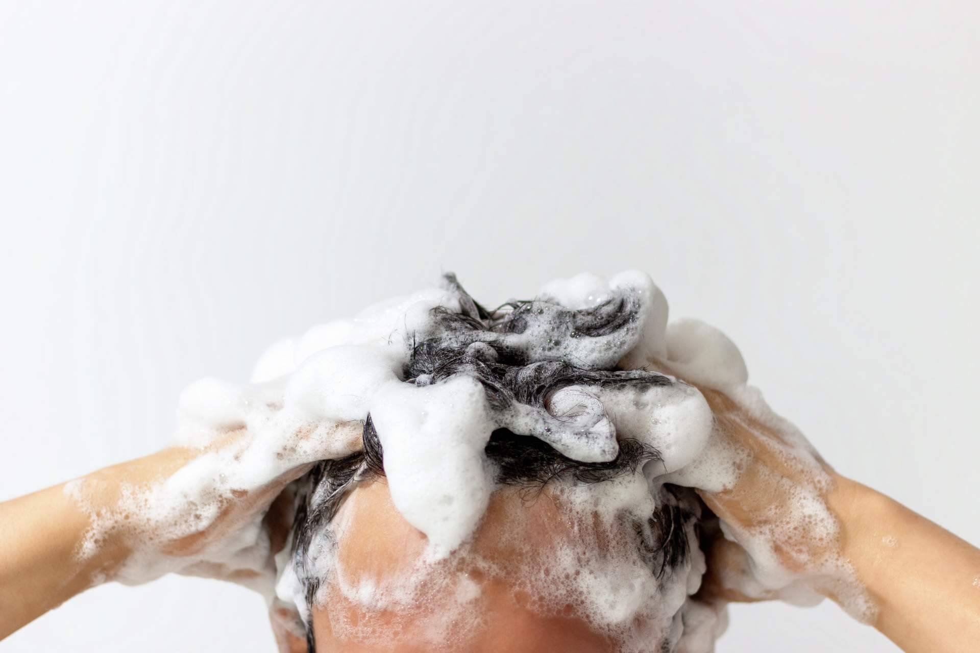El champú de Evocapil tiene la solución para lavar el cabello tras un trasplante capilar