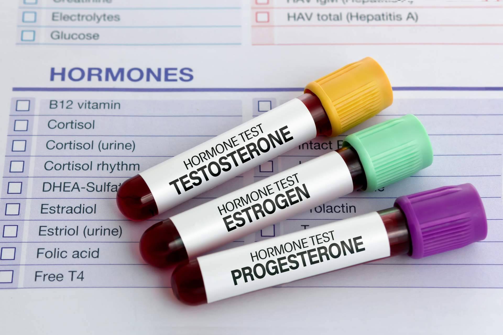 ¿Por qué es necesario un análisis de testosterona?