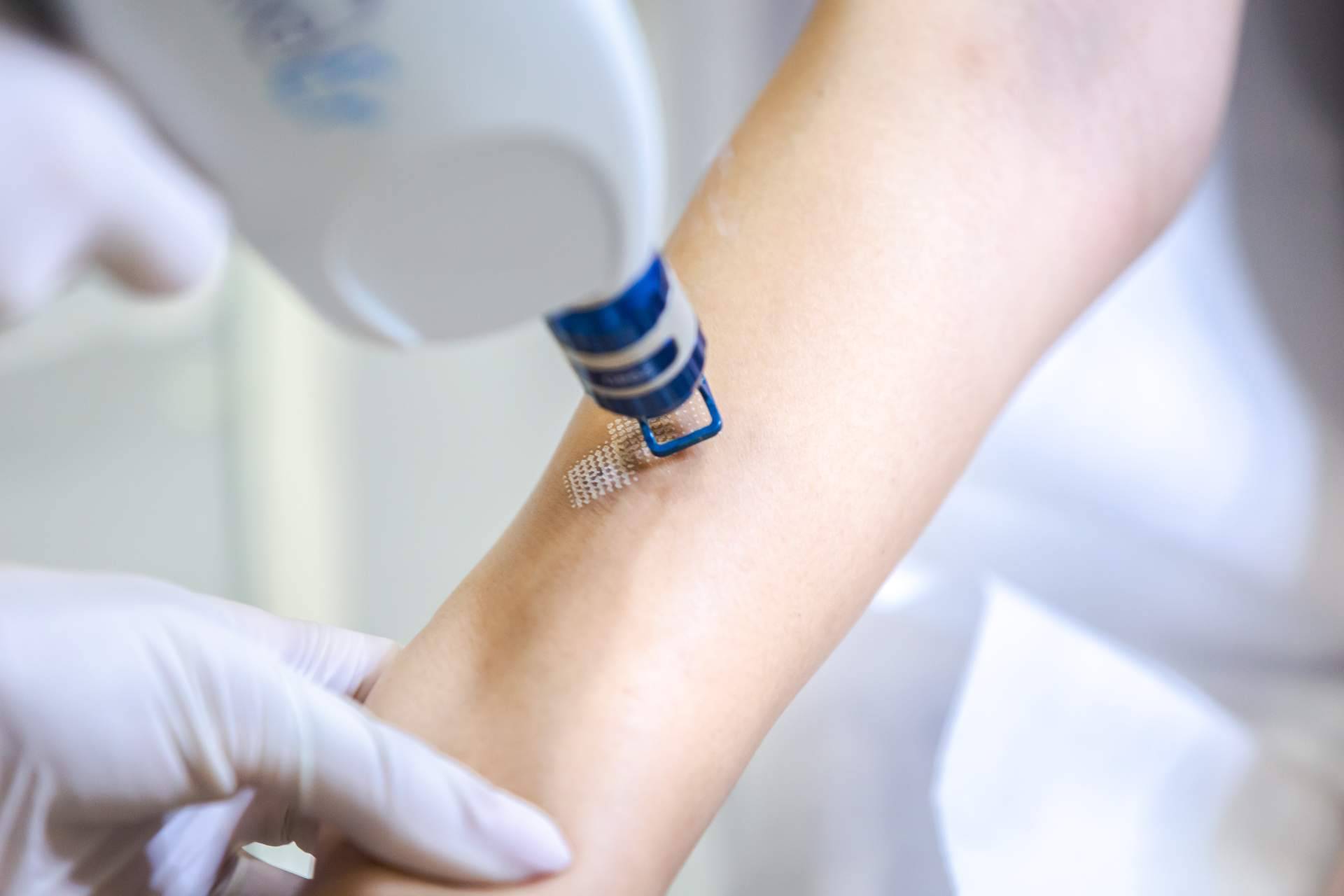 En el Centro Estética El Pilar cuentan con técnicas avanzadas para eliminar cicatrices