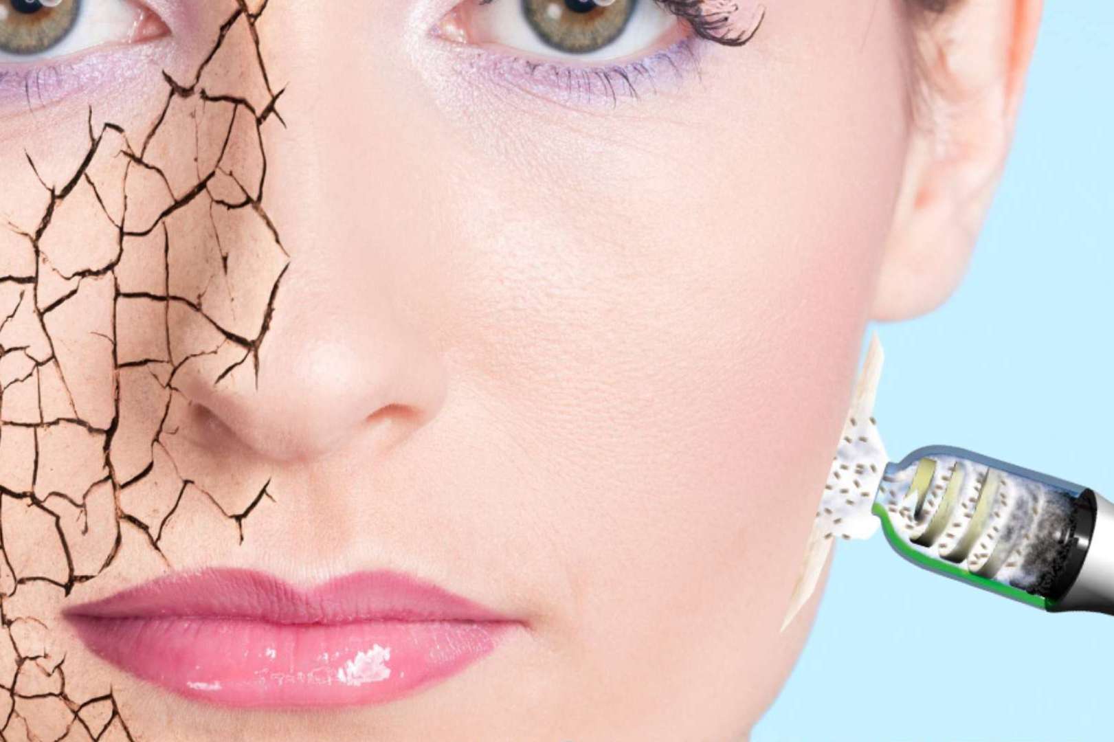 El Vortex Peel es uno de los mejores peelings de alta intensidad