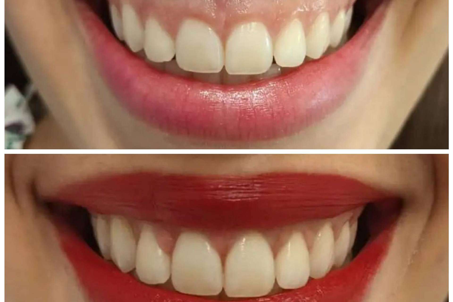 Medicina estética facial y dental para una sonrisa perfecta, con Clínica Calvo de Mora