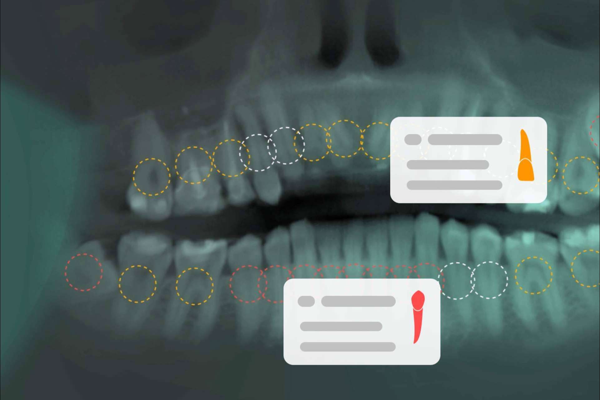 Dentomo trae la inteligencia artificial al ámbito de la odontología