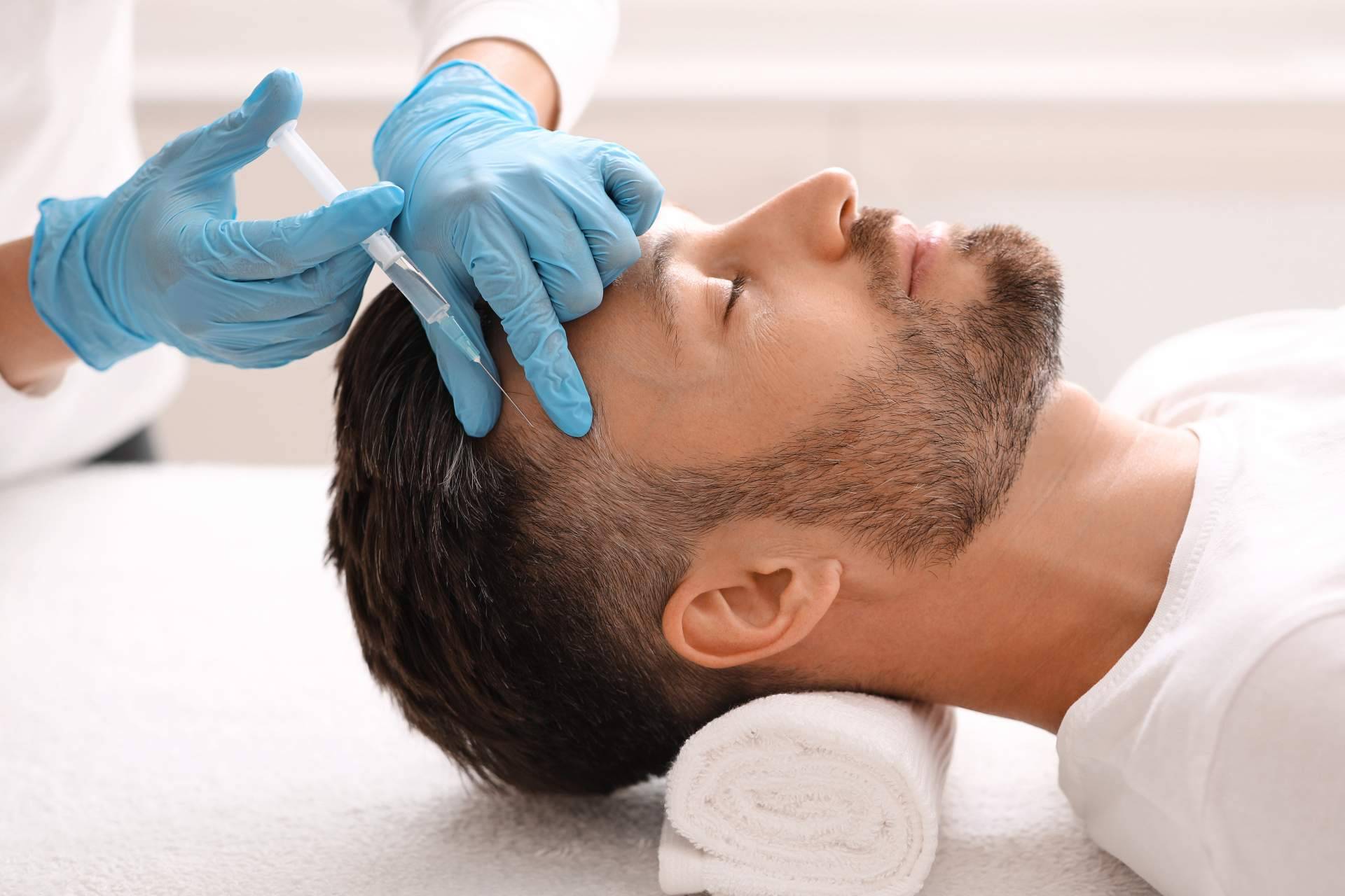Alluring Clinic ofrece un tratamiento de la alopecia androgenética con exosomas
