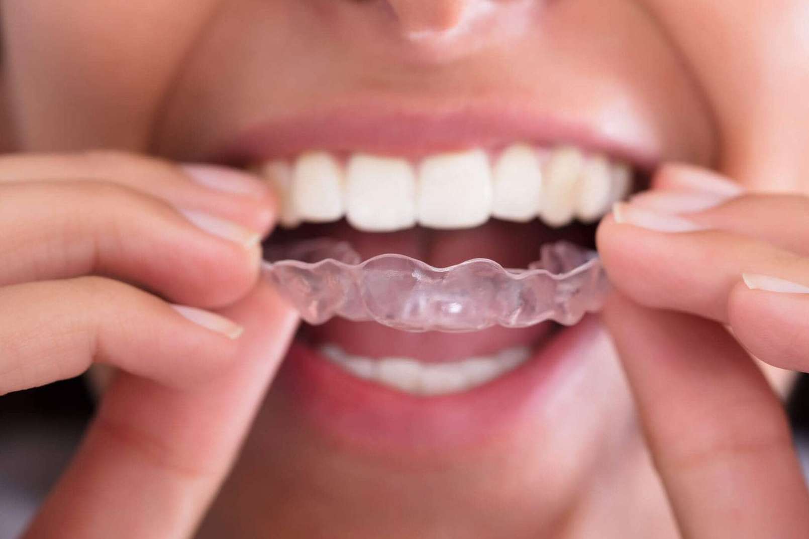 Sonreír con tranquilidad; la importancia de tener un dentista cerca de casa