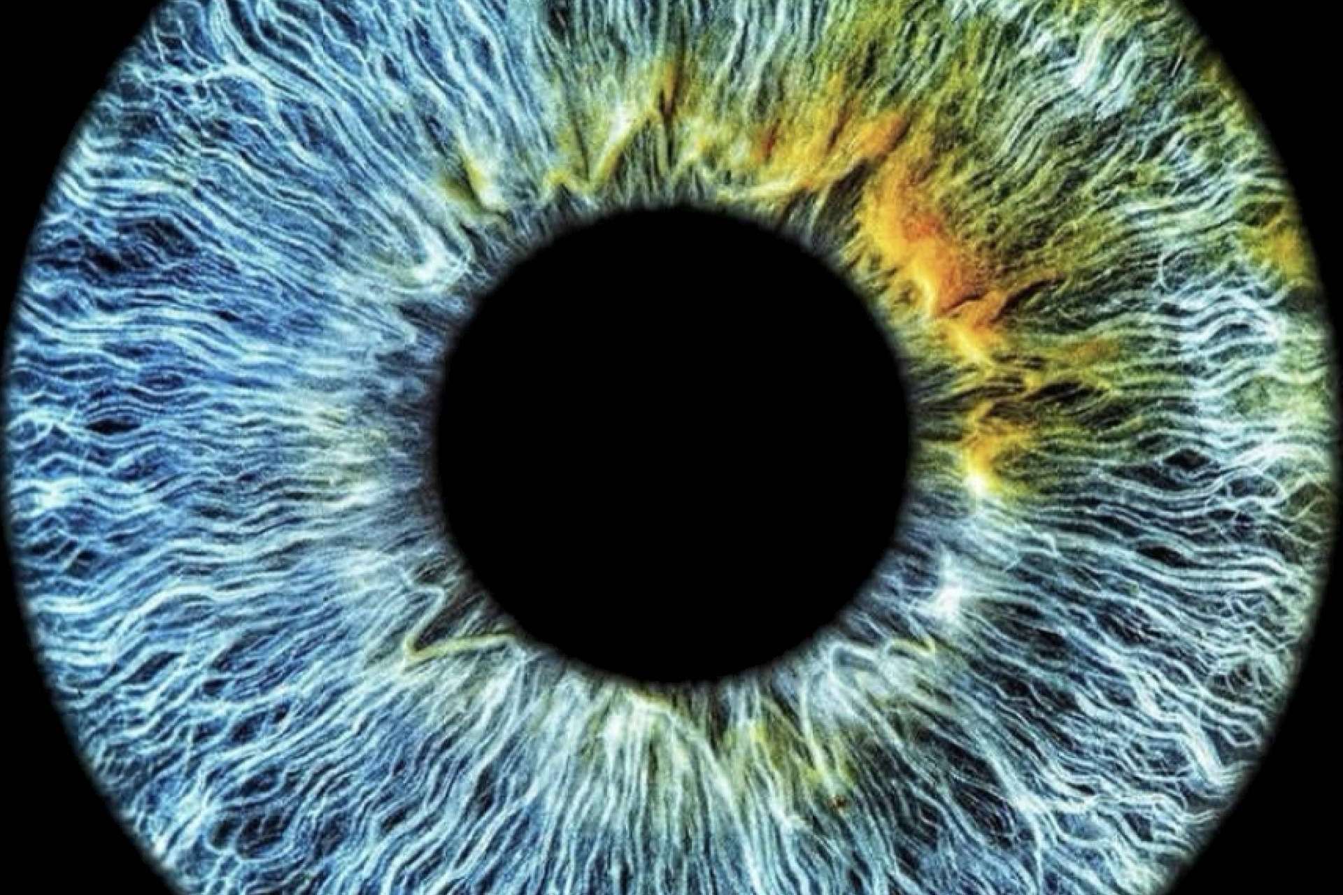 Eyecos revoluciona el cambio de color de ojos con su nuevo láser 10G