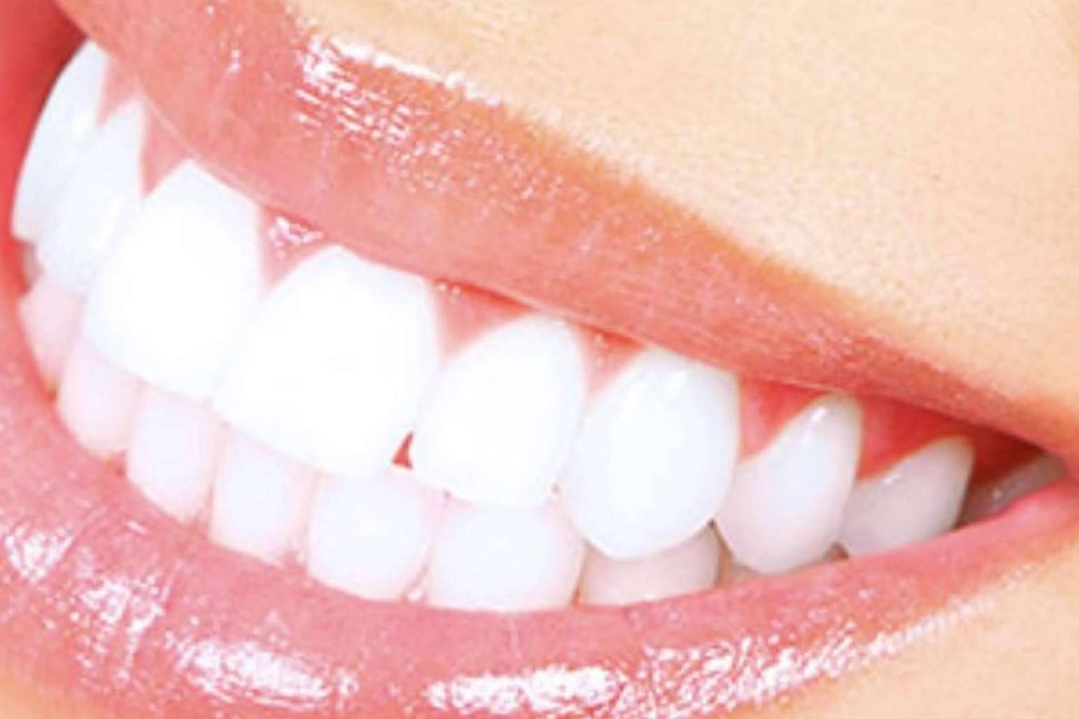 La Clínica Dental Jorge del Corral, en Hortaleza, innova con prótesis fijas de zirconio diseñadas por ordenador