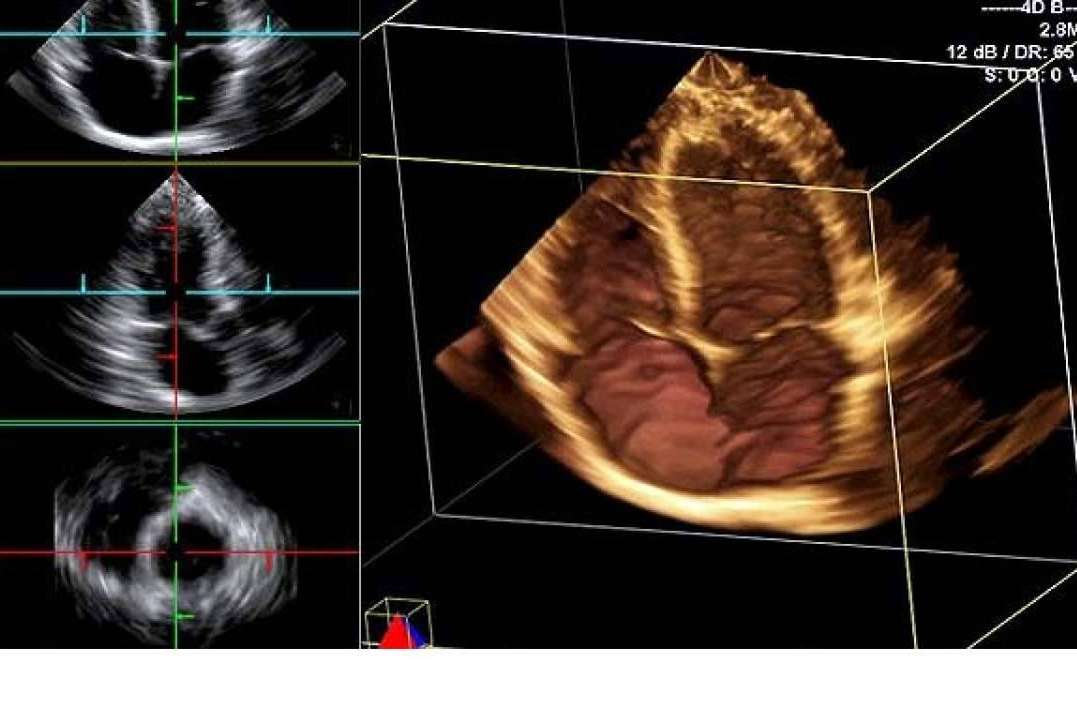 SCPmedical amplía su catálogo con su variedad de ecógrafos accesibles y soporte técnico especializado