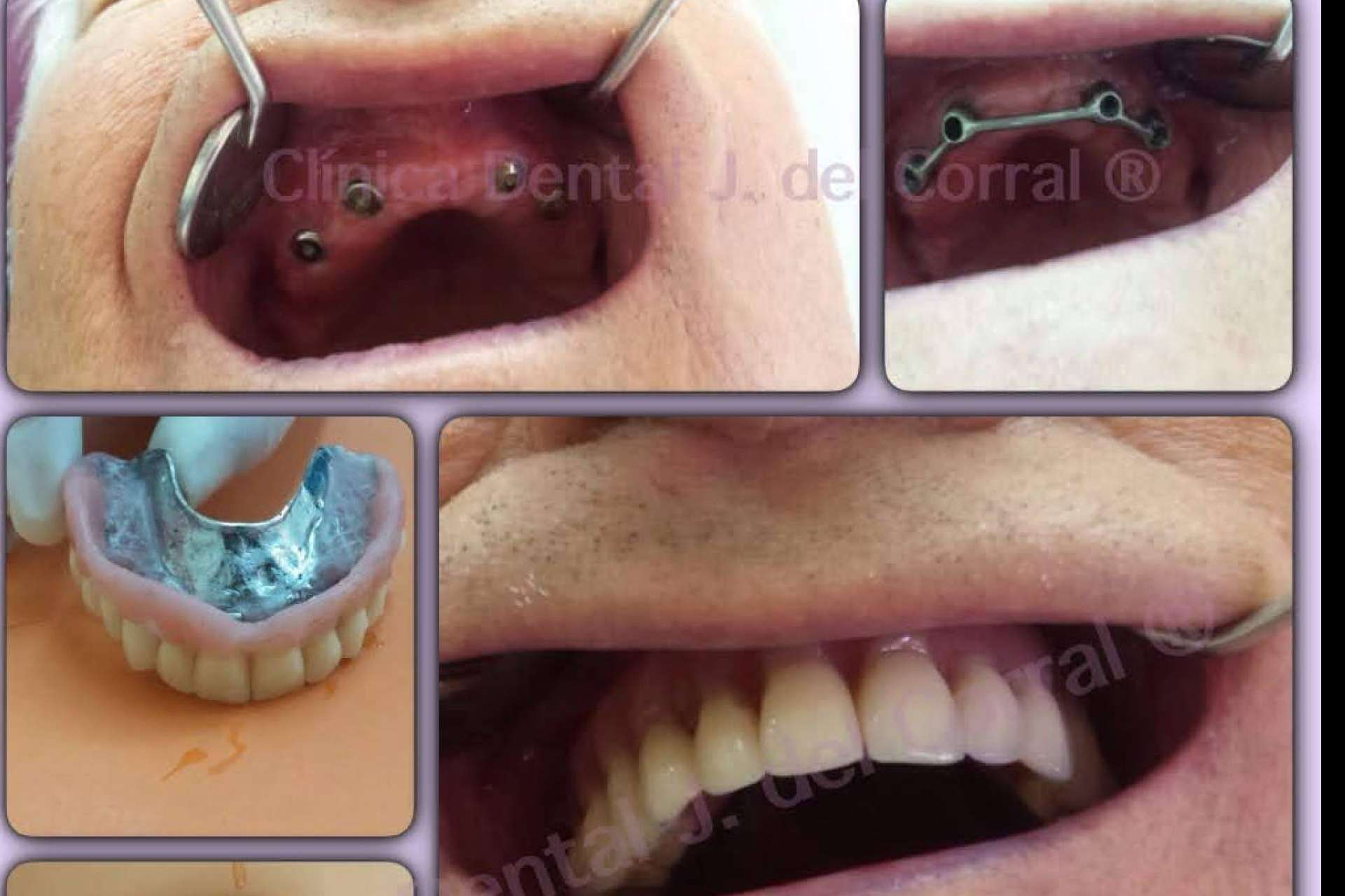 Jorge del Corral, la clínica dental que une calidad, precio y estética en Hortaleza